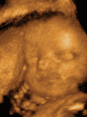 Ultrasound Gif